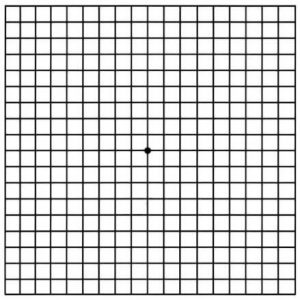 Dry Age Related Macular Degeneration Grid