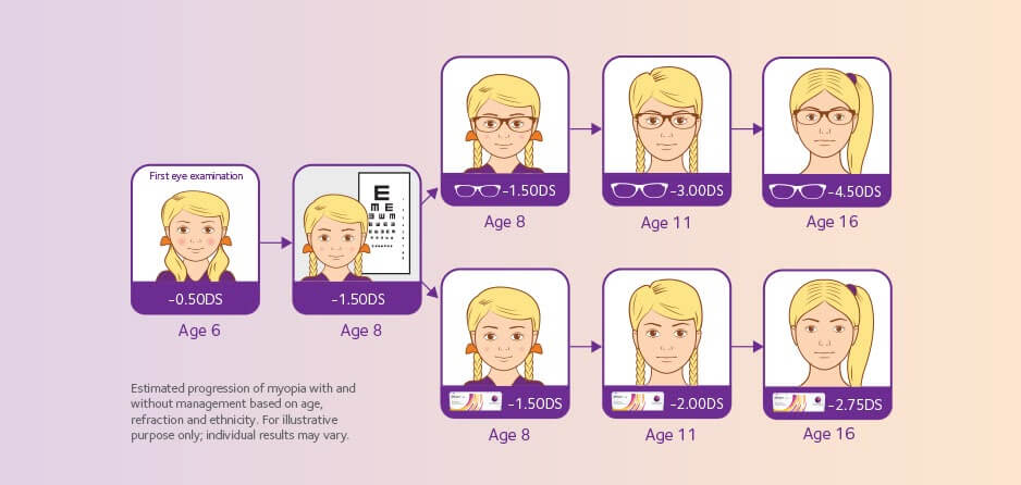 Myopia Management Introduction