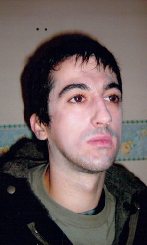 Heroin Cosmetic Contact Lenses for Casualty British TV Series